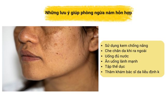 Những lưu ý trên sẽ giúp bạn duy trì làn da khỏe mạnh, hạn chế nám hỗn hợp