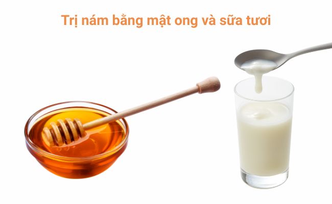 Trị nám bằng mật ong và sữa tươi
