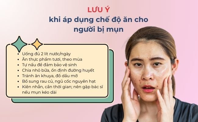 Lưu ý khi áp dụng chế độ ăn cho người bị mụn