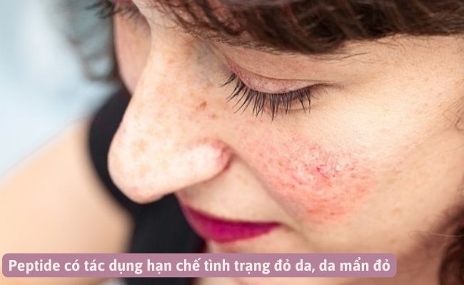Tác dụng của Peptide là gì trong chăm sóc da?