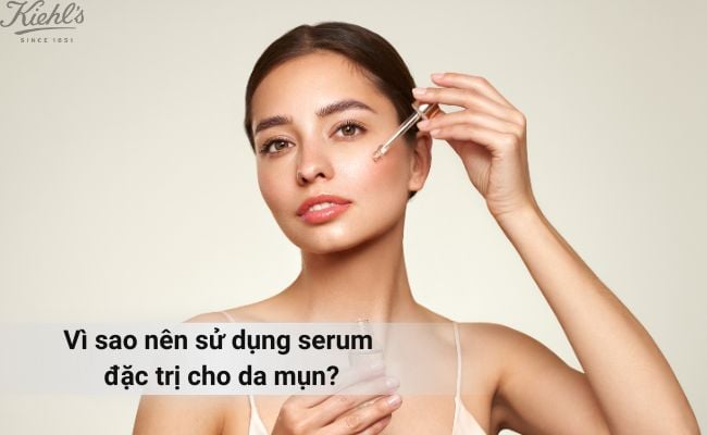 Vì sao nên sử dụng serum đặc trị cho da mụn?