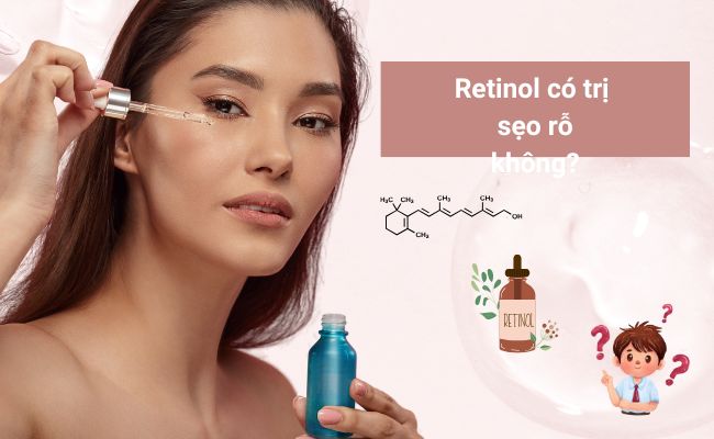 Retinol kích thích sản sinh collagen, hỗ trợ cải thiện kết cấu da và làm đầy sẹo rỗ.