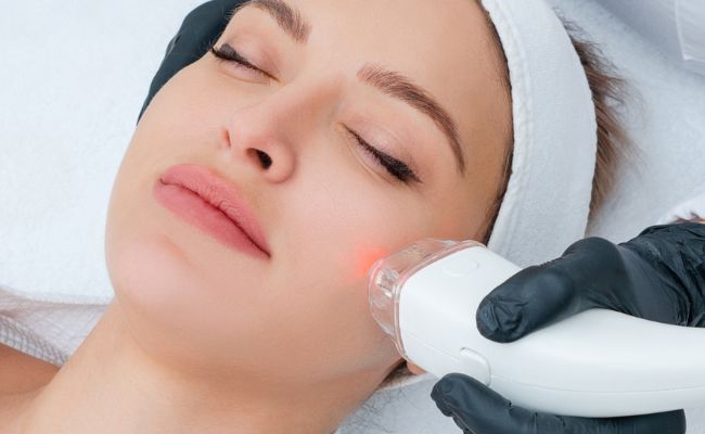 Liệu trình tái tạo da mặt bằng laser