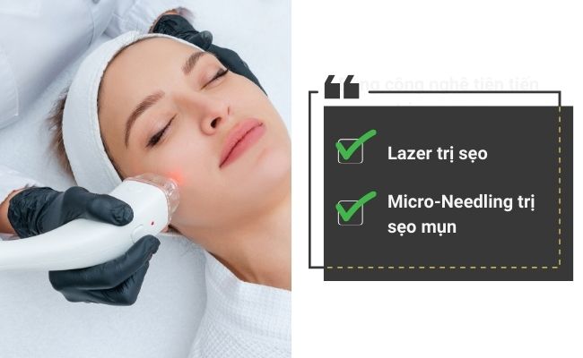20+ cách trị sẹo mụn 2