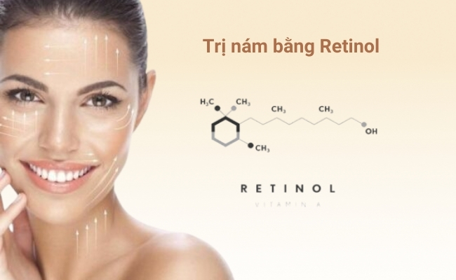Retinol trị nám