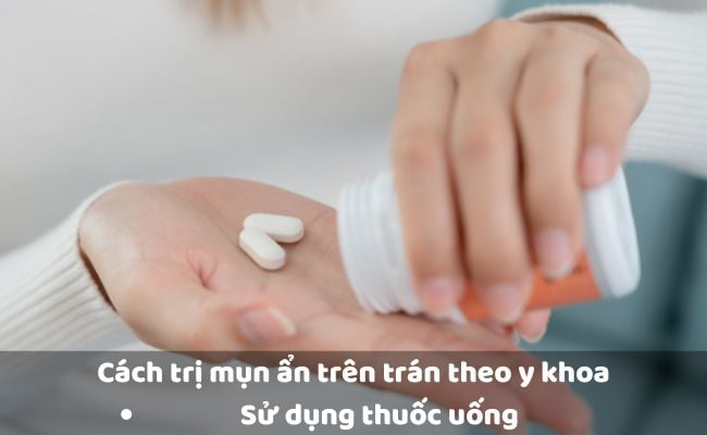 Cách trị mụn ẩn trên trán bằng thuốc uống