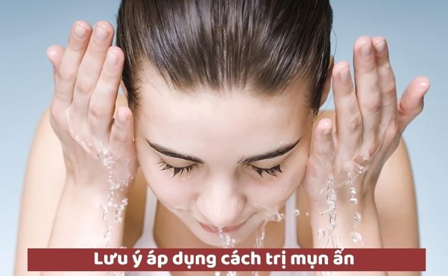 Lưu ý áp dụng cách trị mụn ẩn