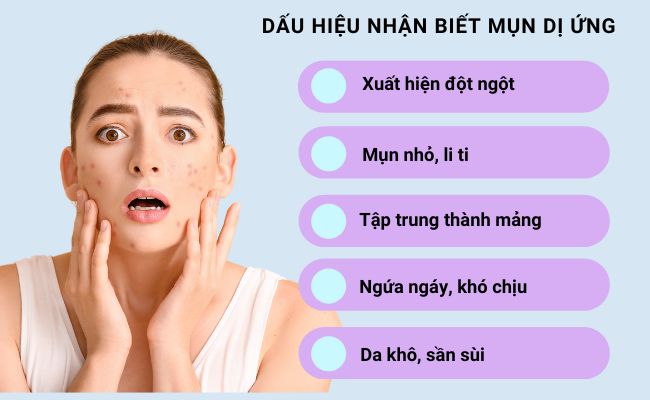 Dấu hiệu nhận biết mụn dị ứng