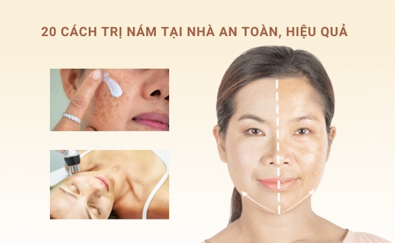 Hình ảnh minh họa về cách trị nám