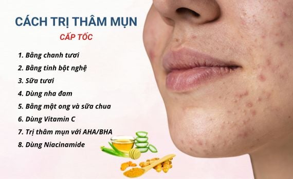 Hình ảnh minh họa về cách trị thâm mụn