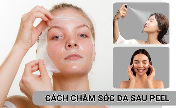 Hình ảnh minh họa về chăm sóc da sau peel