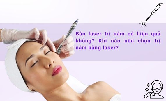 Hình ảnh minh họa về laser trị nám