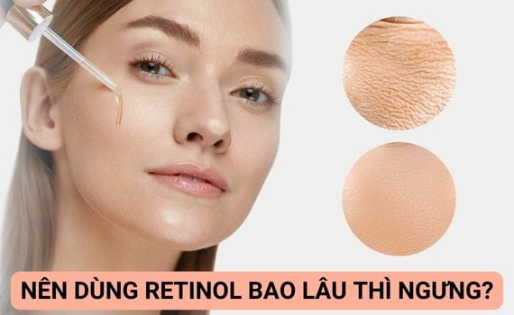 Hình ảnh minh họa về Nên Dùng Retinol Bao Lâu Thì Ngưng
