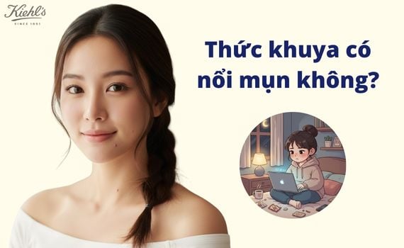 Hình ảnh minh họa về Thức khuya có nổi mụn không