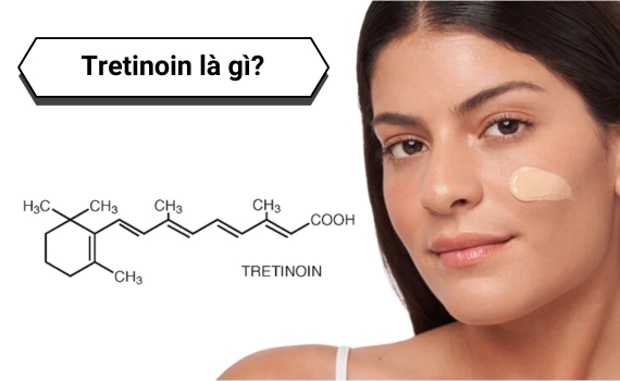 Hình ảnh minh họa về Tretinoin