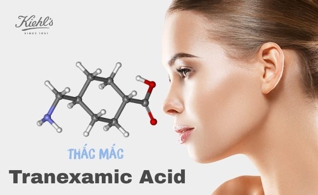 Một số thắc mắc liên quan đến Tranexamic Acid