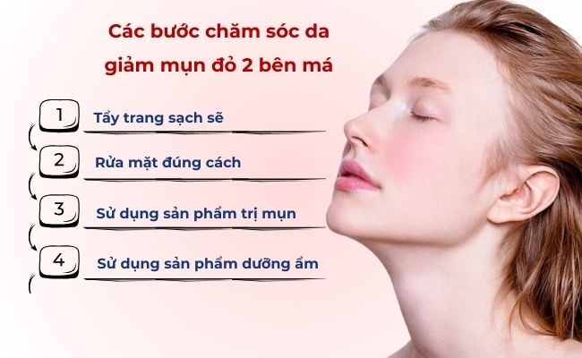 Các bước chăm sóc da giảm mụn đỏ 2 bên má

