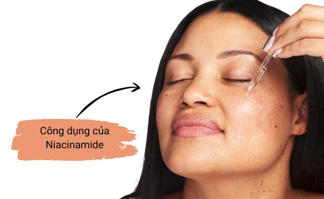 Niacinamide là gì