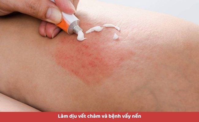 Tinh dầu hoa oải hương có tác dụng gì?