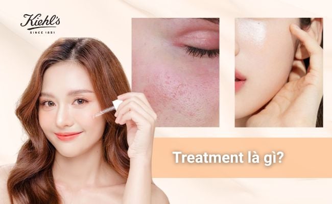 Treatment là gì?
