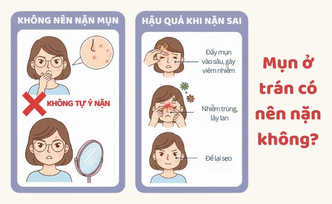 Mụn ở trán có nên nặn không?