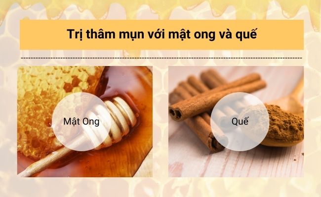 Mật ong và quế giúp làm sạch da, hỗ trợ giảm viêm và thâm mụn.