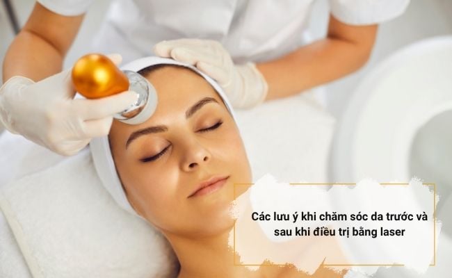 Chăm sóc da sau laser đúng cách trước và sau khi điều trị laser là yếu tố then chốt giúp bạn rút ngắn thời gian hồi phục.