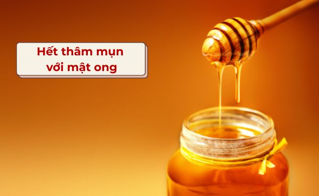 Hết thâm mụn trong 1 tuần với mật ong