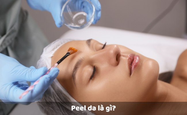 Peel da là gì?