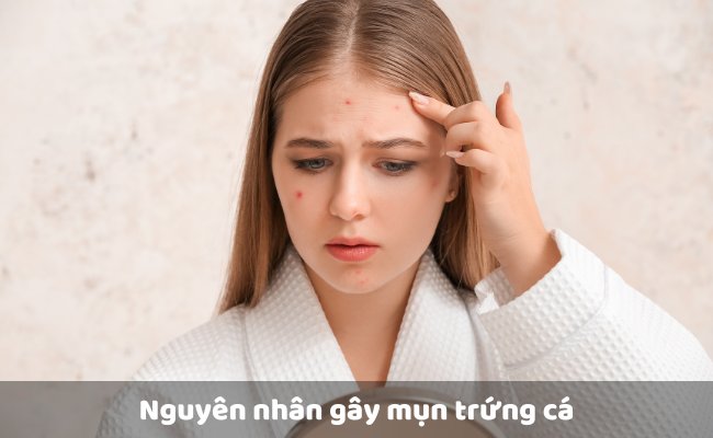 Nguyên nhân gây mụn trứng cá