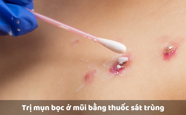 Thuốc sát trùng

