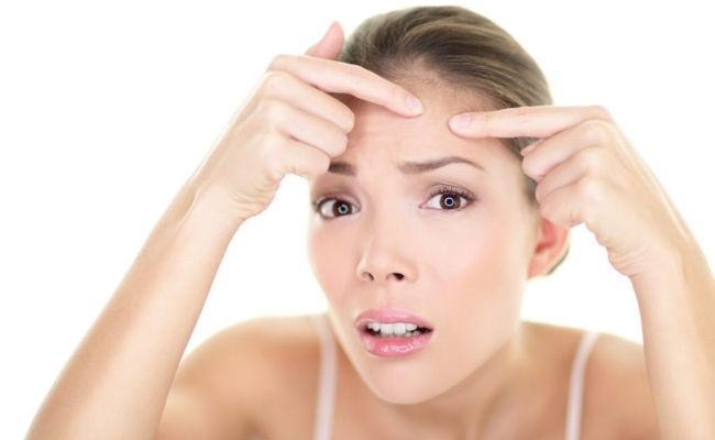 Không tự ý nặn mụn đầu đen tại nhà