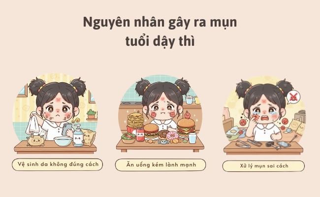 Nguyên nhân gây ra mụn tuổi dậy thì