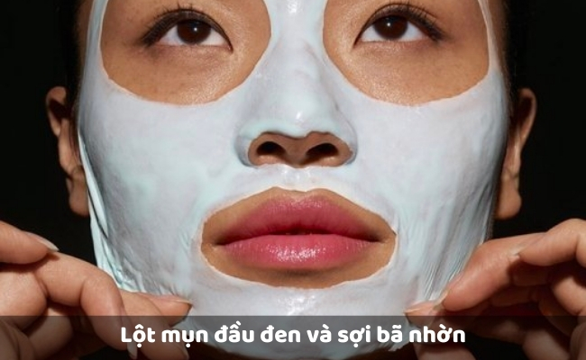 Lột mụn đầu đen và sợi bã nhờn