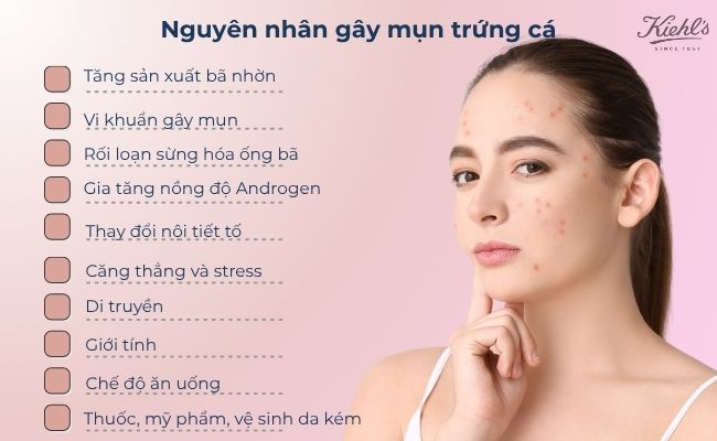 Nguyên nhân gây mụn trứng cá

