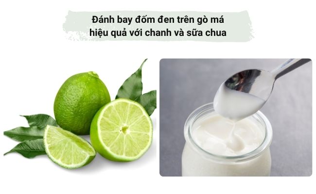 Đánh bay đốm đen trên gò má hiệu quả với chanh và sữa chua
