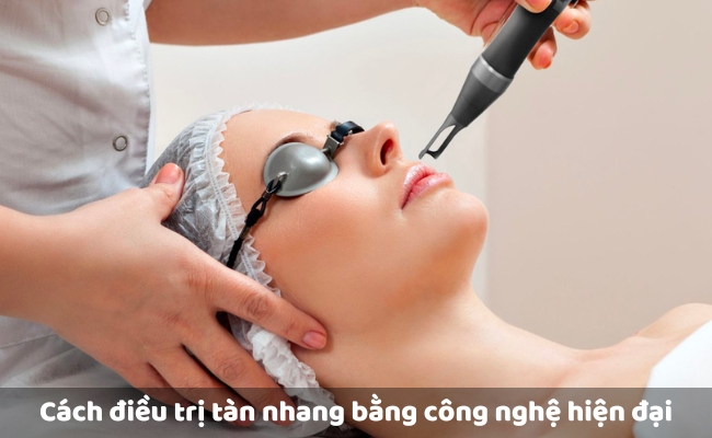 Điều trị nám, tàn nhang, đốm nâu bằng công nghệ hiện đại, an toàn