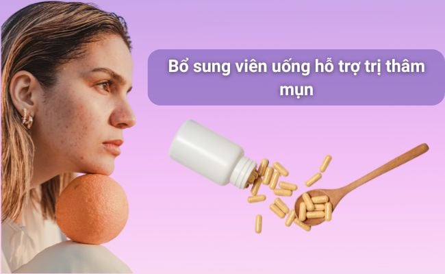 Bổ sung viên uống hỗ trợ trị thâm mụn
