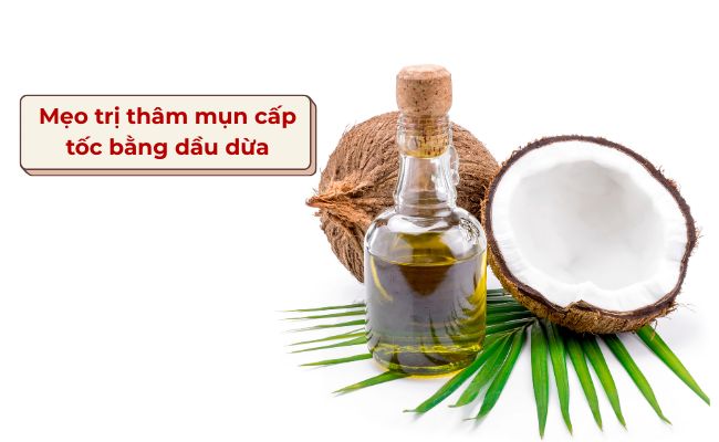Mẹo trị thâm mụn cấp tốc bằng dầu dừa