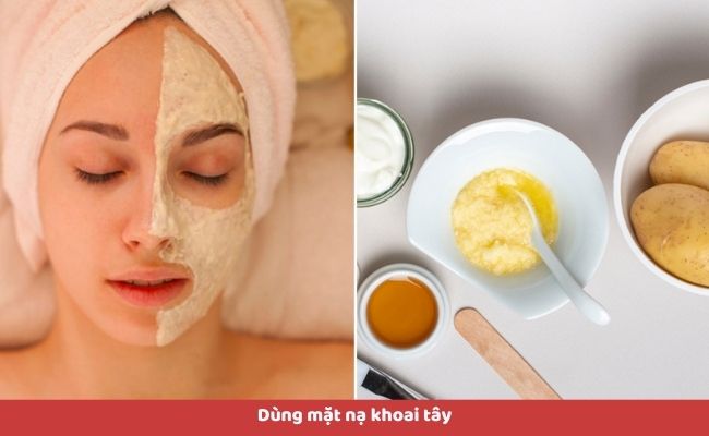 13 cách xóa quầng thâm mắt tại nhà hiệu quả, dễ thực hiện

