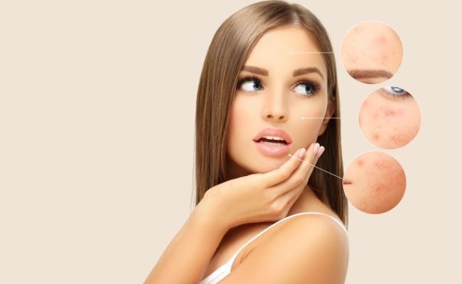 kết hợp bha và niacinamide mang lại hiệu quả gì