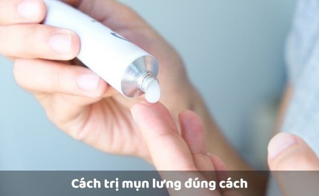 Cách trị mụn lưng đúng cách

