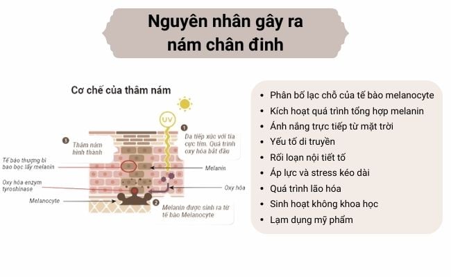 Nguyên nhân gây ra nám chân đinh