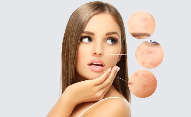 công dụng của vitamin b3 với làn da