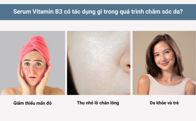 Serum Vitamin B3 có tác dụng gì trong quá trình chăm sóc da? p3