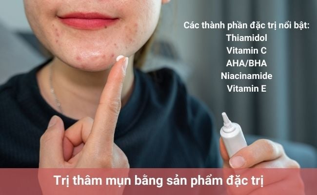 Trị thâm mụn bằng sản phẩm đặc trị