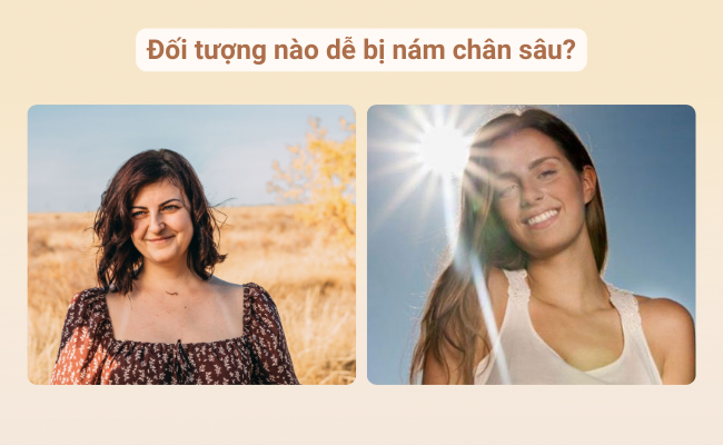Phụ nữ sau tuổi 30, đặc biệt là sau sinh hoặc tiếp xúc nhiều với ánh nắng – nhóm đối tượng dễ bị nám chân sâu nhất.