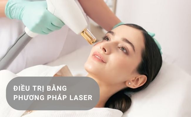 Điều trị bằng phương pháp laser khắc phục da không đều màu