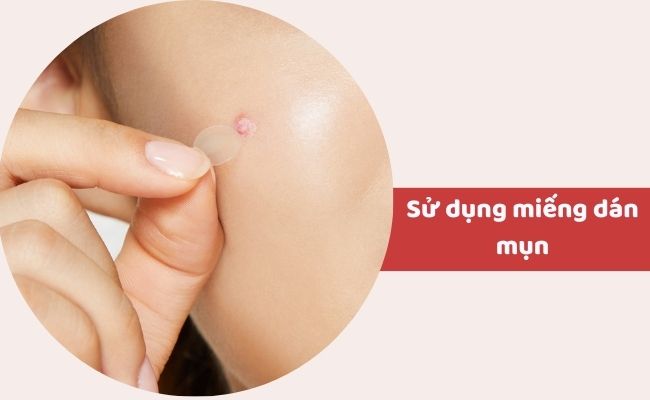 Cách điều trị mụn bọc ở cằm tại nhà?
