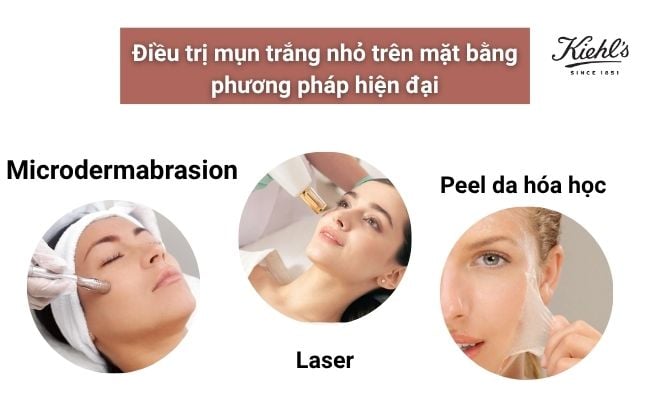 Cách điều trị tình trạng mặt nổi mụn trắng nhỏ

